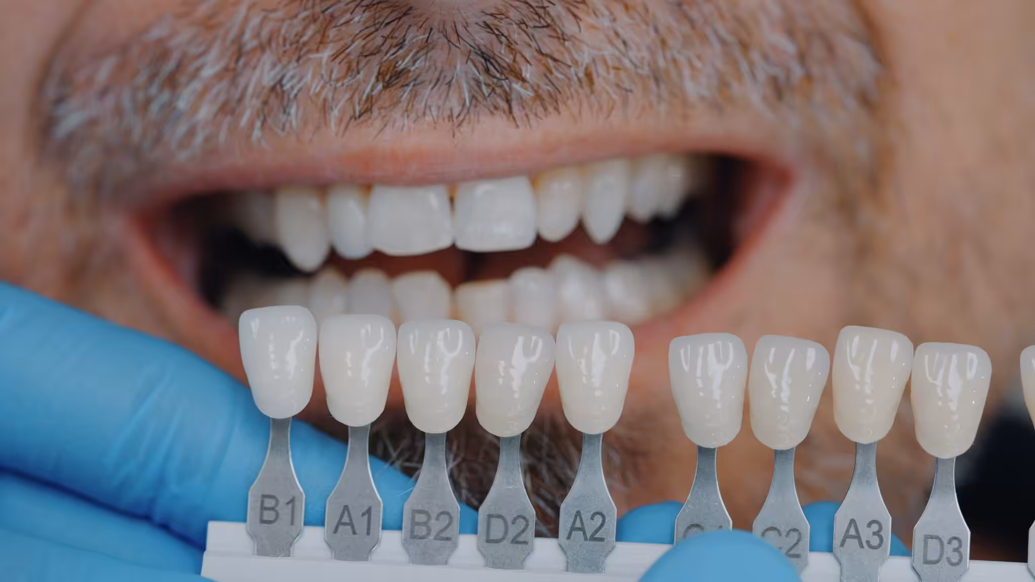 Fotograf clinica dentara mures cluj fotografie doctori pomadent targu mures